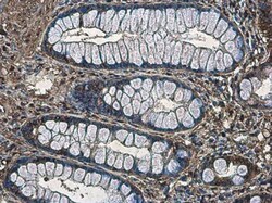 Invitrogen Phospho-MYH9 (Ser1943) Monoclonal Antibody (GT144) 100 &mu;L;