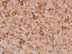 Invitrogen MYH9 Monoclonal Antibody (GT218) 100 &mu;L; Unconjugated:Antibodies,