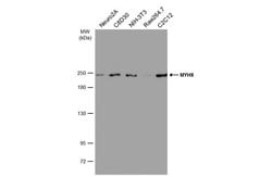 Invitrogen MYH9 Monoclonal Antibody (GT566) 100 &mu;L; Unconjugated:Antibodies,