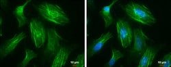Invitrogen MYH10 Monoclonal Antibody (GT246) 100 &mu;L; Unconjugated:Antibodies,