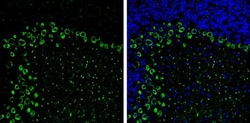 Invitrogen MYH10 Monoclonal Antibody (GT246) 100 &mu;L; Unconjugated:Antibodies,