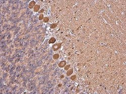 Invitrogen MYH10 Monoclonal Antibody (GT246) 100 &mu;L; Unconjugated:Antibodies,