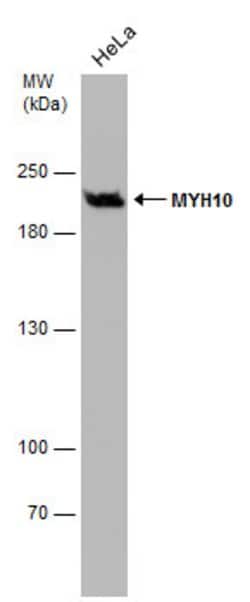 Invitrogen MYH10 Monoclonal Antibody (GT246) 100 &mu;L; Unconjugated:Antibodies,