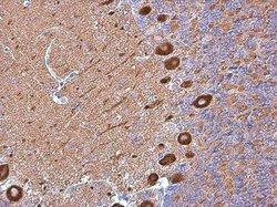 Invitrogen MYH10 Monoclonal Antibody (GT324) 100 &mu;L; Unconjugated:Antibodies,