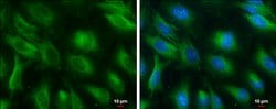 Invitrogen PGAM1 Monoclonal Antibody (GT256) 100 &mu;L; Unconjugated:Antibodies,