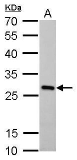 Invitrogen PGAM1 Monoclonal Antibody (GT256) 100 &mu;L; Unconjugated:Antibodies,
