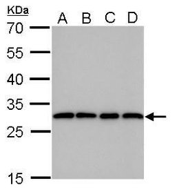 Invitrogen PGAM1 Monoclonal Antibody (GT256) 100 &mu;L; Unconjugated:Antibodies,