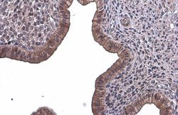 Invitrogen PLS3 Monoclonal Antibody (GT236) 100 &mu;L; Unconjugated:Antibodies,