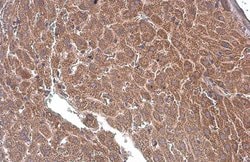 Invitrogen PLS3 Monoclonal Antibody (GT236) 100 &mu;L; Unconjugated:Antibodies,