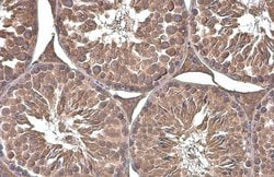 Invitrogen Phospho-Paxillin (Tyr118) Monoclonal Antibody (GT712) 100 &mu;L;