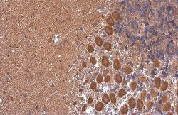 Invitrogen RHEB Monoclonal Antibody (GT39810) 100 &mu;L; Unconjugated:Antibodies,