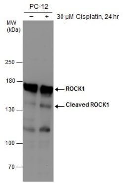 Invitrogen ROCK1 Monoclonal Antibody (GT261) 100 &mu;L; Unconjugated:Antibodies,