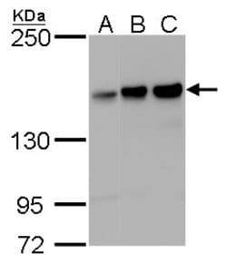 Invitrogen ROCK1 Monoclonal Antibody (GT261) 100 &mu;L; Unconjugated:Antibodies,