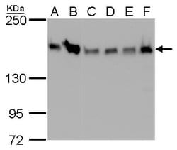 Invitrogen ROCK1 Monoclonal Antibody (GT261) 100 &mu;L; Unconjugated:Antibodies,