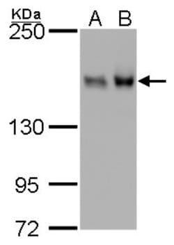 Invitrogen ROCK1 Monoclonal Antibody (GT261) 100 &mu;L; Unconjugated:Antibodies,