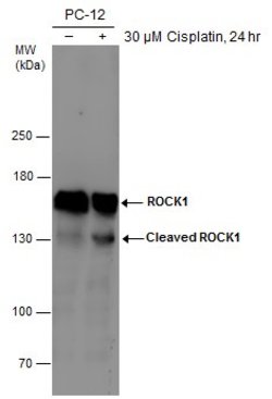 Invitrogen ROCK1 Monoclonal Antibody (GT464) 100 μL; Unconjugated:Antibodies,