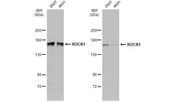 Invitrogen ROCK1 Monoclonal Antibody (GT464) 100 μL; Unconjugated:Antibodies,