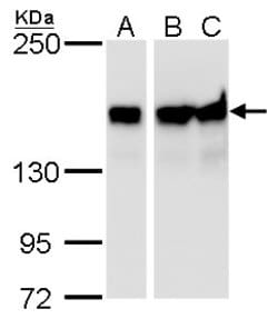 Invitrogen ROCK1 Monoclonal Antibody (GT464) 100 μL; Unconjugated:Antibodies,