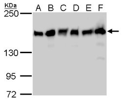 Invitrogen ROCK1 Monoclonal Antibody (GT464) 100 μL; Unconjugated:Antibodies,