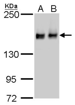 Invitrogen ROCK1 Monoclonal Antibody (GT464) 100 μL; Unconjugated:Antibodies,