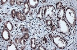 Invitrogen Phospho-p53 (Ser46) Monoclonal Antibody (GT1018) 100 &mu;L;
