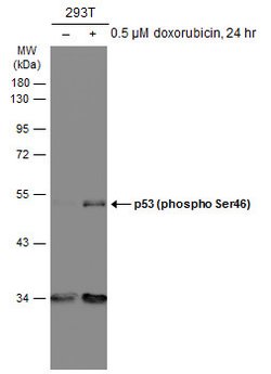 Invitrogen Phospho-p53 (Ser46) Monoclonal Antibody (GT1018) 100 &mu;L;
