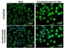 Invitrogen Phospho-p53 (Ser46) Monoclonal Antibody (GT1018) 100 &mu;L;