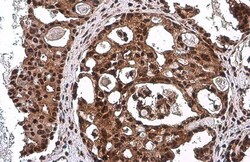 Invitrogen Phospho-p53 (Ser46) Monoclonal Antibody (GT1018) 100 &mu;L;
