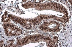 Invitrogen Phospho-p53 (Ser46) Monoclonal Antibody (GT1018) 100 &mu;L;