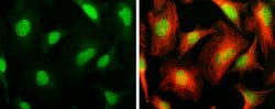 Invitrogen ARID1A Monoclonal Antibody (GT3611) 100 &mu;L; Unconjugated:Antibodies,