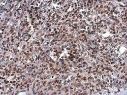 Invitrogen ARID1A Monoclonal Antibody (GT3611) 100 &mu;L; Unconjugated:Antibodies,