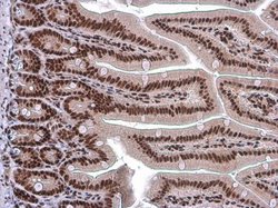 Invitrogen ARID1A Monoclonal Antibody (GT3611) 100 &mu;L; Unconjugated:Antibodies,