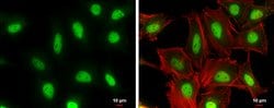 Invitrogen Cullin 4A Monoclonal Antibody (GT885) 100 &mu;L; Unconjugated:Antibodies,