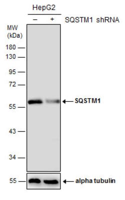 Invitrogen SQSTM1 Monoclonal Antibody (GT1478) 100 &mu;L | Buy Online | Invitrogen&trade; | Fisher Scientific