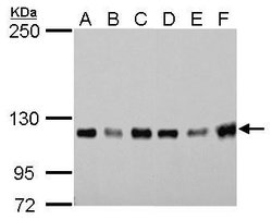 Invitrogen GEF-H1 Monoclonal Antibody (GT1132) 100 &mu;L | Buy Online | Invitrogen&trade; | Fisher Scientific