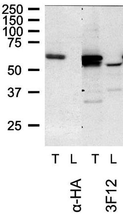 TOM1L1 Monoclonal Antibody (3F12):Antibodies, Monoclonal