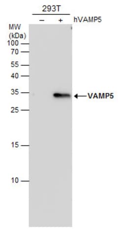 Invitrogen VAMP5 Monoclonal Antibody (3E5) 100 &mu;L; Unconjugated:Antibodies,