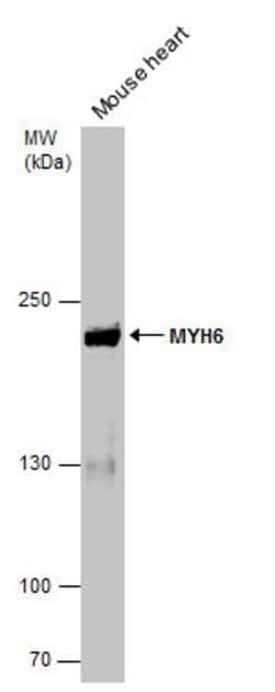 Invitrogen MYH6 Monoclonal Antibody (GT565) 100 &mu;L; Unconjugated:Antibodies,