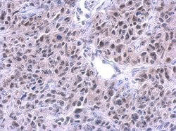 Invitrogen PUF60 Monoclonal Antibody (GT3510) 100 &mu;L; Unconjugated:Antibodies,