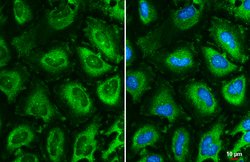 Invitrogen TCP-1 epsilon Monoclonal Antibody (GT639) 100 &mu;L; Unconjugated:Antibodies,