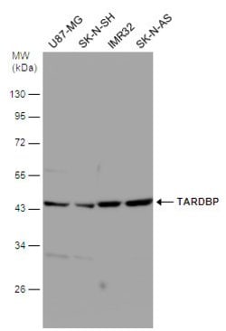 Invitrogen TDP-43 Monoclonal Antibody (GT733) 100 &mu;L | Buy Online | Invitrogen&trade; | Fisher Scientific