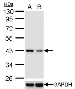 Invitrogen TDP-43 Monoclonal Antibody (GT733) 100 &mu;L | Buy Online | Invitrogen&trade; | Fisher Scientific