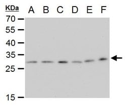 Invitrogen ETHE1 Monoclonal Antibody (GT1621) 100 &mu;L; Unconjugated:Antibodies,