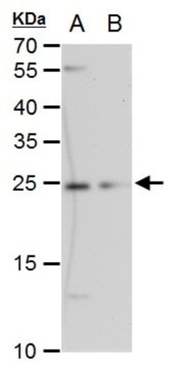 Invitrogen ETHE1 Monoclonal Antibody (GT1621) 100 &mu;L; Unconjugated:Antibodies,