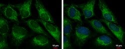 Invitrogen FIS1 Monoclonal Antibody (GT12112) 100 &mu;L; Unconjugated:Antibodies,