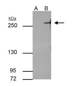 Invitrogen TET2 Monoclonal Antibody (GT649) 100 &mu;L; Unconjugated:Antibodies,