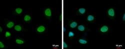 Invitrogen ELP3 Monoclonal Antibody (GT11811) 100 &mu;L; Unconjugated:Antibodies,