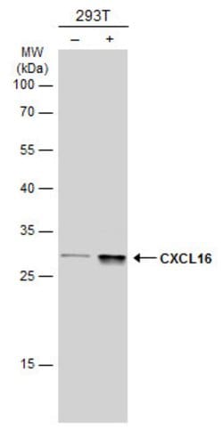 Invitrogen CXCL16 Monoclonal Antibody (GT516) 100 &mu;L; Unconjugated:Antibodies,