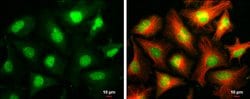 Invitrogen ARID2 Monoclonal Antibody (GT7311) 100 &mu;L; Unconjugated:Antibodies,