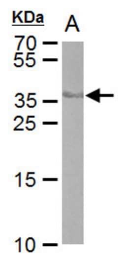 Invitrogen Cre recombinase Monoclonal Antibody (GT10212) 100 &mu;L; Unconjugated:Antibodies,